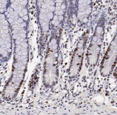 Immunohistochemistry-Paraffin: Ki67/MKI67 Antibody [NBP2-54656] - Staining of human small intestine shows moderate to strong nuclear positivity in glandular cells.