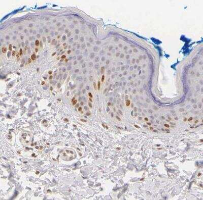 Immunohistochemistry-Paraffin: Ki67/MKI67 Antibody [NBP2-54656] - Staining of human skin shows moderate to string nuclear positivity in a subset of keratinocytes.