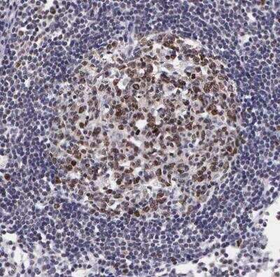 Immunohistochemistry-Paraffin: Ki67/MKI67 Antibody [NBP2-54656] - Staining of human lymph node shows moderate to strong nuclear positivity in germinal center cells.