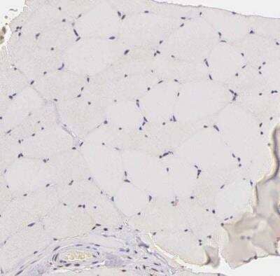 Immunohistochemistry-Paraffin: Ki67/MKI67 Antibody [NBP2-54656] - Staining of human skeletal muscle shows no positivity in myocytes as expected.