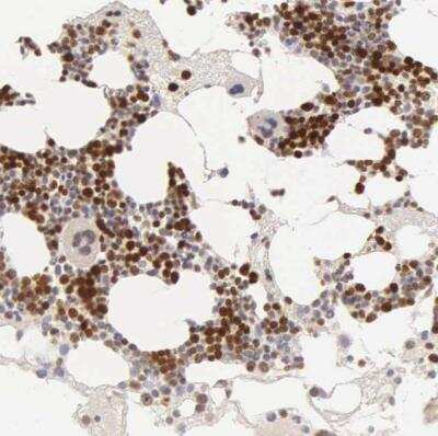 Immunohistochemistry-Paraffin: Ki67/MKI67 Antibody [NBP2-54656] - Staining of human bone marrow shows strong nuclear positivity in hematopoietic cells.