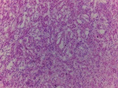 Hematoxylin & Eosin Stain: Kidney Tissue Slides (Adult Normal) [NBP2-77572] - Tissue: Kidney, Human, Normal