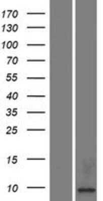 Western Blot Kidney-associated antigen 1 Overexpression Lysate
