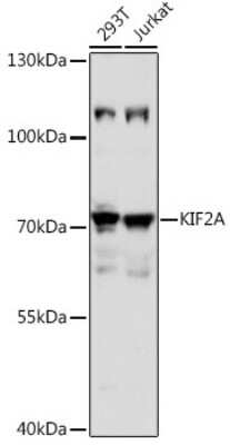 Western Blot: Kif2a Antibody [NBP3-04946] - Western blot analysis of extracts of various cell lines, using Kif2a antibody (NBP3-04946) at 1:1000 dilution. Secondary antibody: HRP Goat Anti-Rabbit IgG (H+L) at 1:10000 dilution. Lysates/proteins: 25ug per lane. Blocking buffer: 3% nonfat dry milk in TBST. Detection: ECL Basic Kit. Exposure time: 5s.