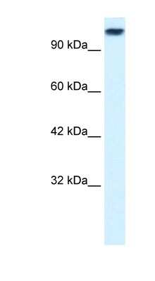 Western Blot: Kif3c Antibody [NBP1-58193] - Hela cell lysate, concentration 0.2-1 ug/ml.