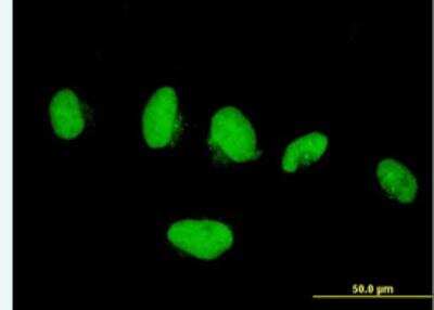 Immunocytochemistry/Immunofluorescence: Kif4A Antibody [H00024137-B01P-50ug] - Purified MaxPab antibody to KIF4A on HeLa cell. [antibody concentration 10 ug/ml]