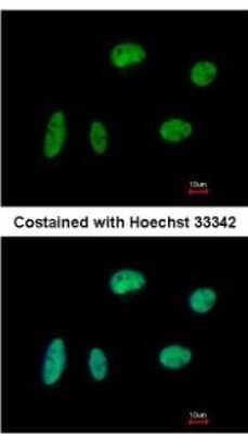 Immunocytochemistry/Immunofluorescence: Kif4A Antibody [NBP2-17056] - Analysis of paraformaldehyde-fixed HeLa, using antibody at 1:200 dilution.