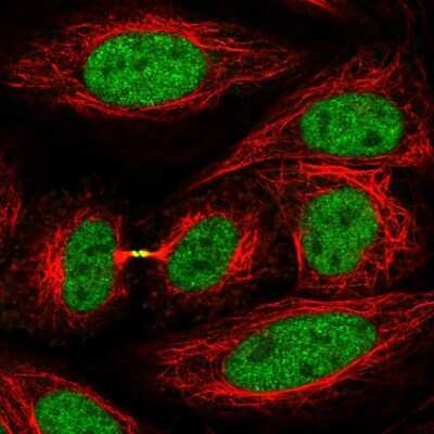 Immunocytochemistry/Immunofluorescence: Kif4A Antibody [NBP2-56589] - Staining of human cell line SiHa shows localization to nucleoplasm & cytokinetic bridge.