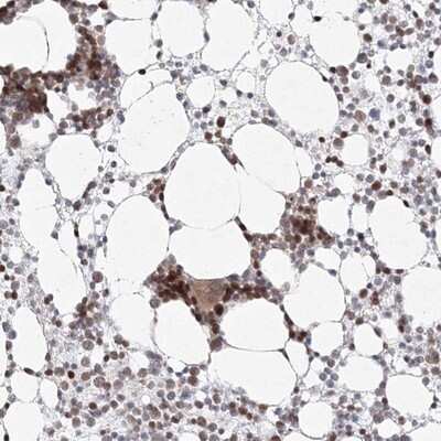 Immunohistochemistry-Paraffin: Kif4A Antibody [NBP1-83720] - Staining of human bone marrow shows strong nuclear positivity in hematopoietic cells.