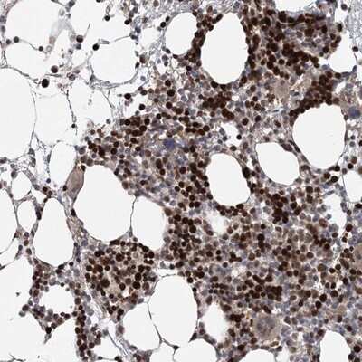 Immunohistochemistry-Paraffin: Kif4A Antibody [NBP1-83721] - Staining of human bone marrow shows strong nuclear positivity in hematopoietic cells.