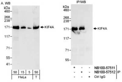 Western Blot: Kif4A Antibody [NB100-57512] - Detection of Human KIF4A on HeLa whole cell lysate using NB100-57512. KIF4A was also immunoprecipitated by rabbit anti-KIF4A antibody NB100-57511.