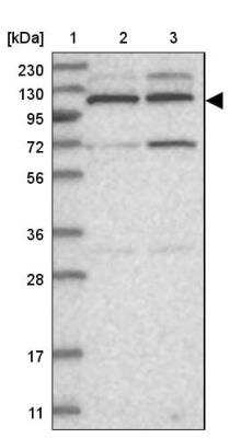 Western Blot: Kif4A Antibody [NBP1-83720] - Lane 1: Marker  [kDa] 230, 130, 95, 72, 56, 36, 28, 17, 11.  Lane 2: Human cell line RT-4.  Lane 3: Human cell line U-251MG sp