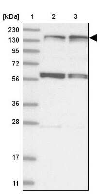 Western Blot: Kif4A Antibody [NBP1-83721] - Lane 1: Marker  [kDa] 230, 130, 95, 72, 56, 36, 28, 17, 11.  Lane 2: Human cell line RT-4.  Lane 3: Human cell line U-251MG sp