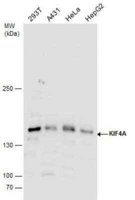 Western Blot: Kif4A Antibody [NBP2-17056] -  Various whole cell extracts (30 ug) were separated by 5% SDS-PAGE, and the membrane was blotted with KIF4A antibody diluted by 1:1000.