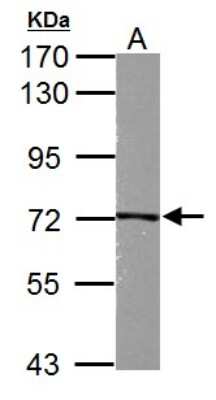 Western Blot: Kindlin-2 Antibody [NBP2-17059] - Sample (30 ug of whole cell lysate) A: PC-12 7. 5% SDS PAGE gel, diluted at 1:3000.