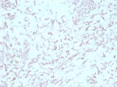 Immunohistochemistry-Paraffin: Kindlin Antibody (4A5.14) - Azide and BSA Free [NBP3-08647] - Formalin-fixed, paraffin-embedded human liver stained with Kindlin Mouse Monoclonal Antibody (4A5.14).