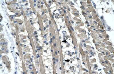 Immunohistochemistry-Paraffin: Kinesin 5B Antibody [NBP1-58118] - Human Muscle Tissue, Skeletal muscle cells (Indicated with Arrows) 4-8ug/ml.