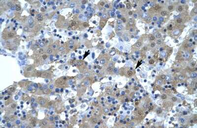 Immunohistochemistry-Paraffin: Kinesin 5B Antibody [NBP1-58177] - Human Liver Tissue, antibody concentration 4-8ug/ml. Cells with positive label: Hepatocytes (indicated with arrows) 400X magnification.