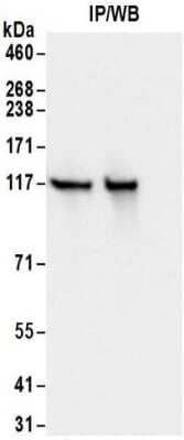 <b>Biological Strategies Validation. </b>Immunoprecipitation: Kinesin 5B Antibody [NBP2-32278] - Samples:  Whole cell lysate (0.5 or 1.0 mg per IP reaction; 20% of IP loaded) from 293T and cells.  Antibodies: Affinity purified rabbit anti-Kinesin 5B antibody NBP2-32278 used for IP at 6 ug per reaction. For blotting immunoprecipitated Kinesin 5B was used at 1 ug/ml.  Detection: Chemiluminescence with an exposure time of 1 second.