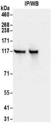 <b>Biological Strategies Validation. </b>Immunoprecipitation: Kinesin 5B Antibody [NBP2-32279] - Samples:  Whole cell lysate (0.5 or 1.0 mg per IP reaction; 20% of IP loaded) from 293T and cells. Antibodies:  Affinity purified rabbit anti-Kinesin 5B antibody NBP2-32279 used for IP at 6 ug per reaction. For blotting immunoprecipitated Kinesin 5B, NBP2-32279 was used at 1 ug/ml. Detection: Chemiluminescence with an exposure time of 1 second.