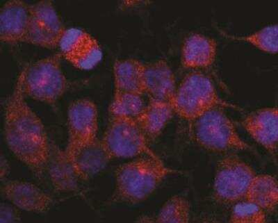 Immunocytochemistry/Immunofluorescence: Kinesin 5B Antibody (KN-03) [NB500-531] - Staining of vesicles (red) in RBL-2H3 rat basophilic leukemia cell line using anti-Kinesin (KN-03). Nuclei were stained with DAPI (blue).