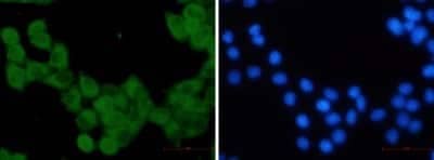 Immunocytochemistry/Immunofluorescence: Kinesin 5B Antibody (S04-6G8) [NBP3-14868] - Immunofluorescence of Kinesin 5B (green) in Hela using Kinesin 5B Rabbit mAb at dilution 1/5, and DAPI (blue)