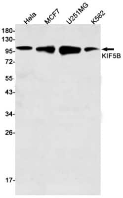 Western Blot: Kinesin 5B Antibody (S04-6G8) [NBP3-14868] - Western blot detection of Kinesin 5B in Hela, MCF7, U251MG, K562 cell lysates using Kinesin 5B Rabbit mAb (1:500 diluted). Predicted band size: 110kDa. Observed band size: 110kDa.