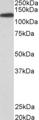 Western Blot: Kinesin 5B Antibody [NB100-1059] - Staining of HeLa cell lysates (35 ug protein in RIPA buffer). Antibody at 0.03 ug/mL. Primary incubation was 1 hour. Detected by chemiluminescence.