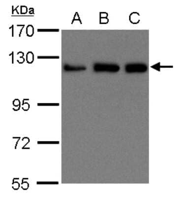 Western Blot: Kinesin 5B Antibody [NBP1-31022] - Sample (30 ug of whole cell lysate) A: 293T B: A431 C: H1299 15% SDS PAGE, antibody diluted at 1:1500.