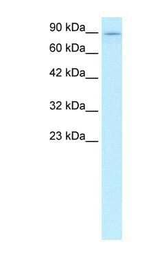 Western Blot: Kinesin 5B Antibody [NBP1-58118] - WB Suggested Anti-KIF5B Antibody Titration: 0.2-1 ug/ml Positive Control: Human brain