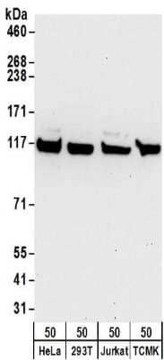 Western Blot: Kinesin 5B Antibody [NBP2-32278] - Samples:  Whole cell lysate (50 ug) from HeLa, 293T, Jurkat, and mouse TCMK-1 cells. Antibodies:  Affinity purified rabbit anti-Kinesin 5B antibody NBP2-32278 used for WB at 1 ug/ml.  Detection: Chemiluminescence with an exposure time of 30 seconds.