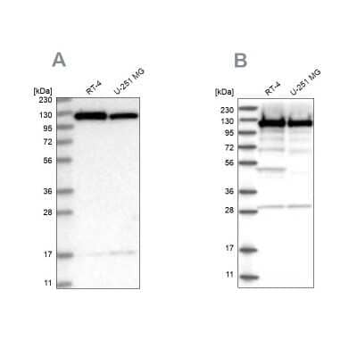 Western Blot: Kinesin 5B Antibody [NBP2-58450] - Analysis using Anti-KIF5B antibody NBP2-58450 (A) shows similar pattern to independent antibody NBP2-58451 (B).