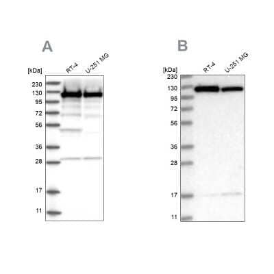 Western Blot: Kinesin 5B Antibody [NBP2-58451] - Analysis using Anti-KIF5B antibody NBP2-58451 (A) shows similar pattern to independent antibody NBP2-58450 (B).