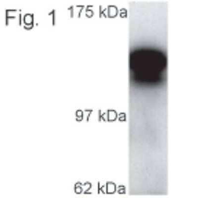 Western Blot: Kinesin 5C Antibody [NB120-5630] - Analysis of kinesin 5C on human retinal extract.
