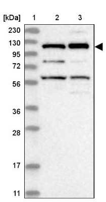 Western Blot: Kinesin 5C Antibody [NBP1-87429] - Lane 1: Marker  [kDa] 230, 130, 95, 72, 56, 36, 28, 17, 11.  Lane 2: Human cell line RT-4.  Lane 3: Human cell line U-251MG sp