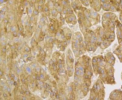 Immunohistochemistry: Kininogen 1 Antibody (JE43-72) [NBP2-76883] - Immunohistochemical analysis of paraffin-embedded human liver tissue using anti-Kininogen 1 antibody. The section was pre-treated using heat mediated antigen retrieval with Tris-EDTA buffer (pH 8.0-8.4) for 20 minutes. The tissues were blocked in 5% BSA for 30 minutes at room temperature, washed with ddH2O and PBS, and then probed with the antibody at 1/100 dilution, for 30 minutes at room temperature and detected using an HRP conjugated compact polymer system. DAB was used as the chrogen. Counter stained with hematoxylin and mounted with DPX.