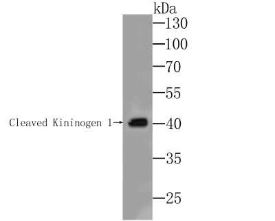 Western Blot: Kininogen 1 Antibody (JE43-72) [NBP2-76883] - Western blot analysis of Kininogen 1 on mouse stomach lysate. Proteins were transferred to a PVDF membrane and blocked with 5% BSA in PBS for 1 hour at room temperature. The primary antibody was used at a 1:500 dilution in 5% BSA at room temperature for 2 hours. Goat Anti-Rabbit IgG - HRP Secondary Antibody (HA1001) at 1:5,000 dilution was used for 1 hour at room temperature.