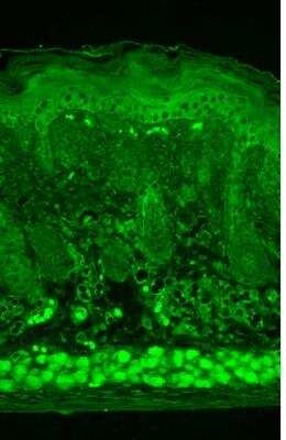 Immunohistochemistry: Kir2.2 Antibody (S124B-38) [NBP2-12901] - Tissue: backskin. Species: Mouse. Fixation: Bouin's Fixative and paraffin-embedded. Primary Antibody: Mouse Anti-Kir2.2 Potassium Channel Monoclonal Antibody at 1:1000 for 1 hour at RT. Secondary Antibody: FITC Goat Anti-Mouse (green) at 1:50 for 1 hour at RT.