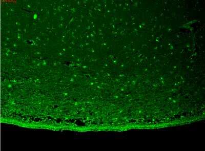 Immunohistochemistry: Kir2.2 Antibody (S124B-38) [NBP2-12901] - Tissue: hippocampus. Species: Human. Fixation: Bouin's Fixative and paraffin-embedded. Primary Antibody: Mouse Anti-Kir2.2 Potassium Channel Monoclonal Antibody  at 1:1000 for 1 hour at RT. Secondary Antibody: FITC Goat Anti-Mouse (green) at 1:50 for 1 hour at RT.