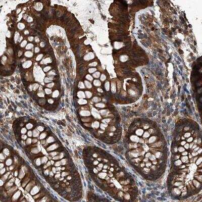 Immunohistochemistry: Kir2.1 Antibody [NBP1-87709] - Staining of human colon shows strong cytoplasmic and membrane positivity in glandular cells.