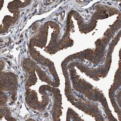 Immunohistochemistry-Paraffin: Kir2.1 Antibody [NBP1-87709] - Staining of human fallopian tube shows moderate cytoplasmic positivity in glandular cells.