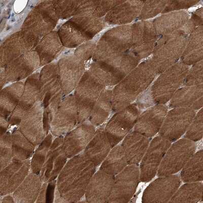 Immunohistochemistry-Paraffin: Kir2.1 Antibody [NBP1-87709] - Staining of human skeletal muscle shows strong cytoplasmic positivity in myocytes.