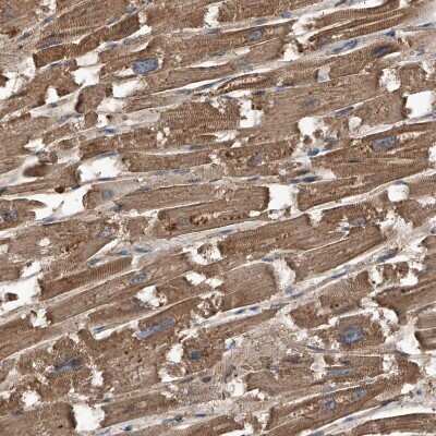 Immunohistochemistry-Paraffin: Kir2.1 Antibody [NBP1-87709] - Staining of human heart muscle shows strong cytoplasmic positivity in cardiomyocytes.