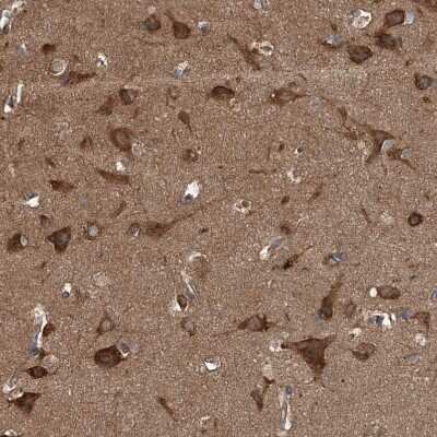 Immunohistochemistry-Paraffin: Kir2.1 Antibody [NBP1-87709] - Staining of human cerebral cortex shows strong cytoplasmic positivity in neurons.