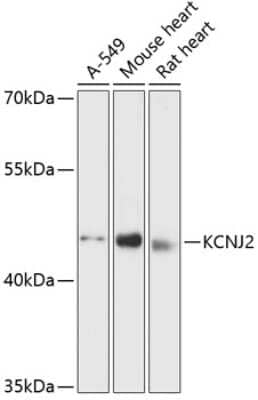 Western Blot: Kir2.1 Antibody [NBP3-03675] - Analysis of extracts of various cell lines, using Kir2.1 antibody at 1:3000 dilution. Secondary antibody: HRP Goat Anti-Rabbit IgG (H+L) at 1:10000 dilution. Lysates/proteins: 25ug per lane. Blocking buffer: 3% nonfat dry milk in TBST. Detection: ECL Basic Kit