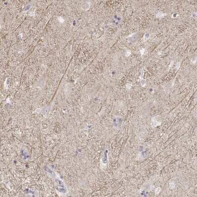 Immunohistochemistry-Paraffin: Kir2.2 Antibody [NBP1-89696] - Staining of human hippocampus shows moderate cytoplasmic positivity in neuronal processes.