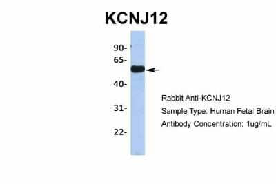 Western Blot: Kir2.2 Antibody [NBP2-87693] - Host: Rabbit. Target Name: KCNJ12. Sample Type: Human Fetal Brain. Antibody Dilution: 1.0ug/ml