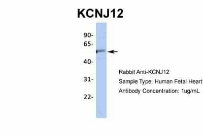 Western Blot: Kir2.2 Antibody [NBP2-87693] - Host: Rabbit. Target Name: KCNJ12. Sample Type: Human Fetal Heart. Antibody Dilution: 1.0ug/ml