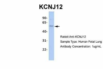 Western Blot: Kir2.2 Antibody [NBP2-87693] - Host: Rabbit. Target Name: KCNJ12. Sample Type: Human Fetal Lung. Antibody Dilution: 1.0ug/ml