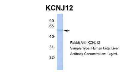 Western Blot: Kir2.2 Antibody [NBP2-87693] - Host: Rabbit. Target Name: KCNJ12. Sample Type: Human Fetal Liver. Antibody Dilution: 1.0ug/ml